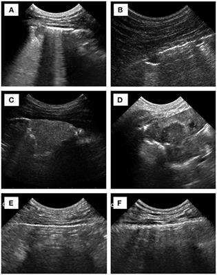 Usefulness of Chest Ultrasonography in Predicting Diagnosis in Non-emergency Small Animal Patients With Lung Parenchymal and Pleural Disease